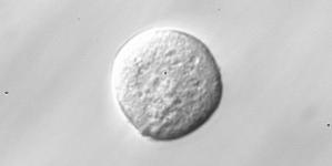shown in the figure below, it seems reasonable to assume that the natural shape of a blastomere might be approximately like a sphere. Figure 11: A single blastomere extracted from a human embryo. 5.
