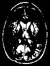 fig 4.(a) shows the original MRI image, Fig 4.(b) shows the ground truth image, Fig 4.(c) shows the segmented image of HSOM method, Fig4.