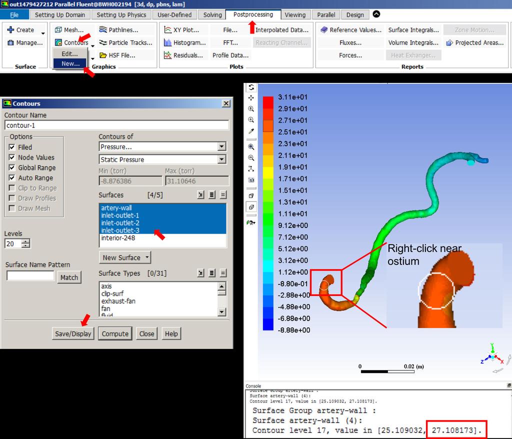 32. First, we will extract the relative pressure solved for at the ostium by the CFD simulation. In the menu bar, click on Postprocessing, click Contours ( ) and select New.