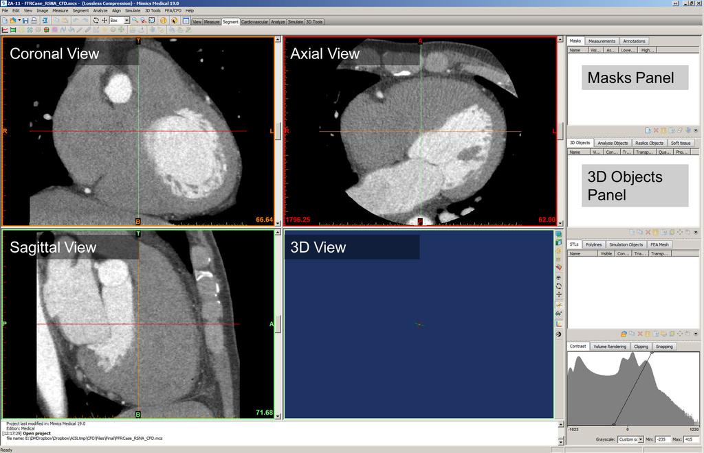 If you are instead starting with the DICOM images, use the New project wizard from the file menu and go through the steps of importing & confirming the DICOM images.