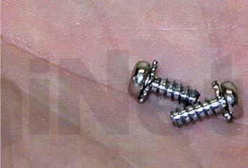 these screws
