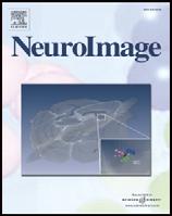 NeuroImage 44 (2009) 99 111 Contents lists available at ScienceDirect NeuroImage journal homepage: www.elsevier.