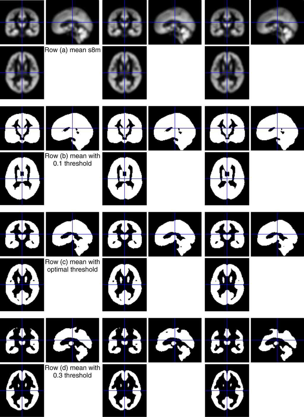 110 G.R. Ridgway et al. / NeuroImage 44 (2009) 99 111 Fig. 10. Further investigation of masks derived from the group average segmentation.