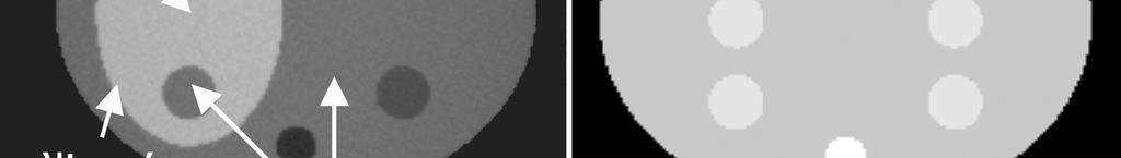 Figure D is the difference image of the bilinear scaled image and the PET transmission image highlighting the significant errors in the contrast cylinder.