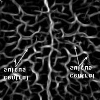 cortical surface) for (a) the first and (b) the second (target) image used in the third experiment in