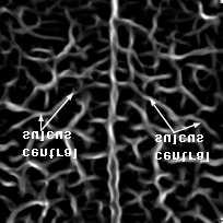 In (c) we show the elastically warped map in (a) obtained by matching the central sulcus and the