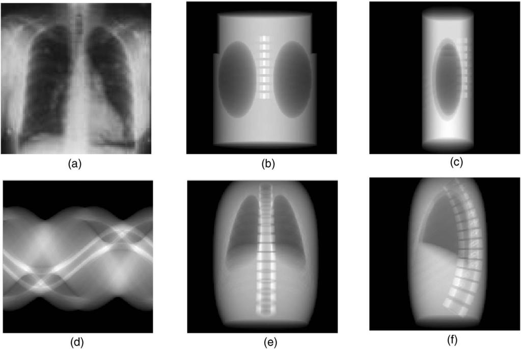 3139 Zhu et al.: Computed tomography simulation with superquadrics 3139 FIG. 3. 3D thorax phantom. a Front view; b side view. FIG. 2. Flow chart for computing the x-ray transform for a superellipsoid.