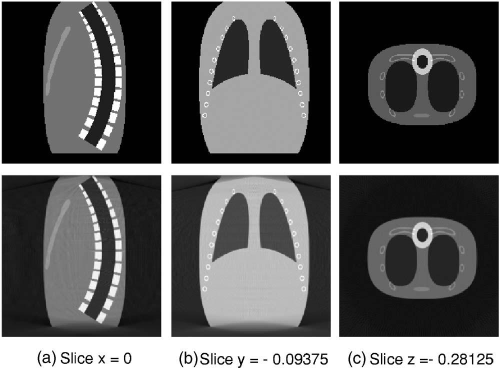 3140 Zhu et al.: Computed tomography simulation with superquadrics 3140 FIG. 5. Representative slices of the superquadrics-based thorax phantom.