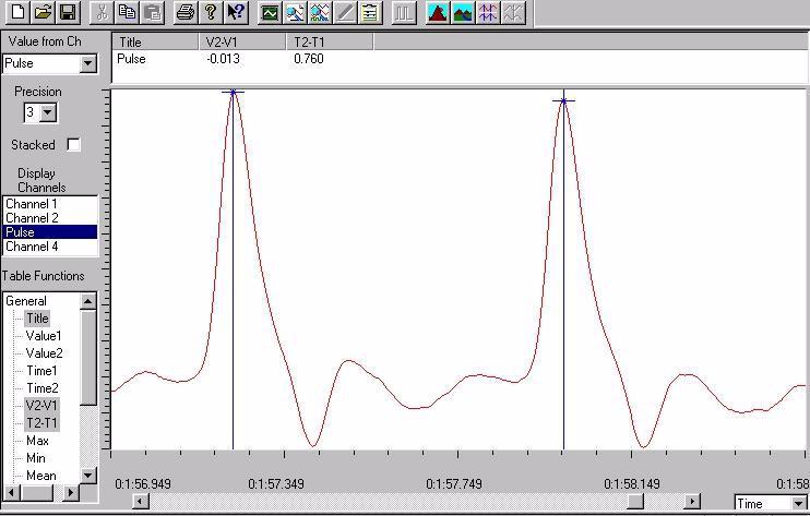 Before the Analysis window can be opened, a section of data in the Main window must be selected (Figure1-7 on page 9). Figure 1-8: A finger pulse recording in the Analysis window.