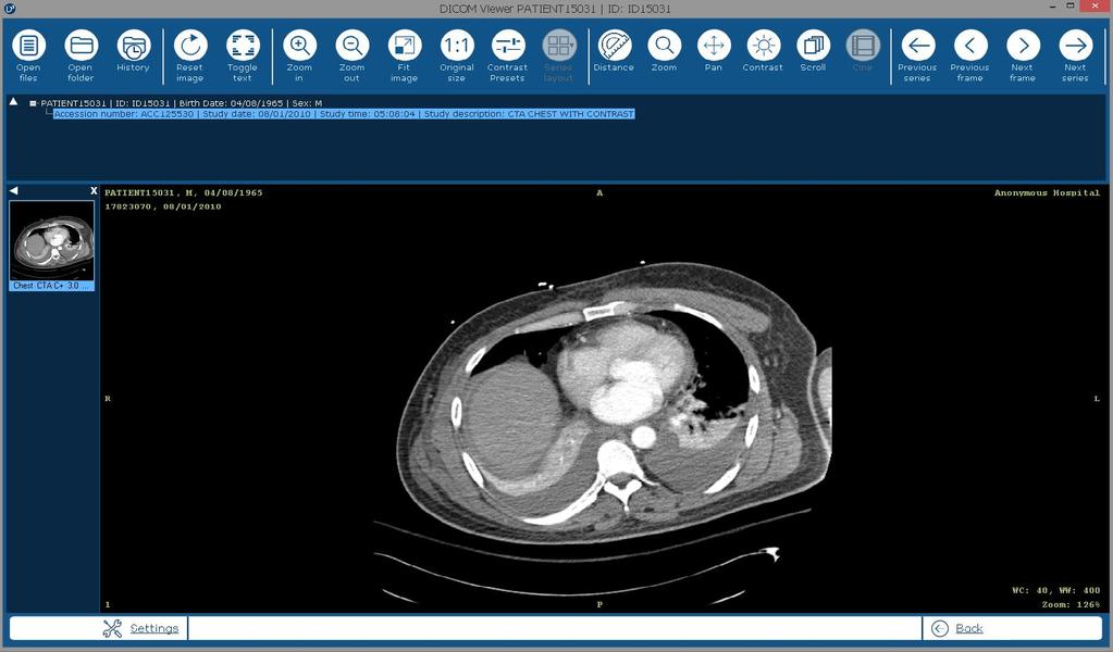 3. DICOM Viewer DICOMIZER 5.2 is a powerful and friendly Multi-Modality DICOM Viewer. The DICOM Viewer consists of: 1.