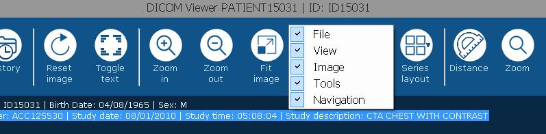 2. Patients and Studies tree right click on the study row to show the context menu with options to send the study to PACS, close it (remove from the viewer) or export it to external media (available