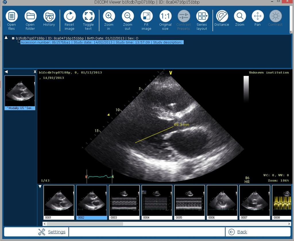 4.7. Display Grayscale Softcopy Presentation State module DICOMIZER can display relative annotations (graphics, text and etc.) stored in files of specific DICOM format.