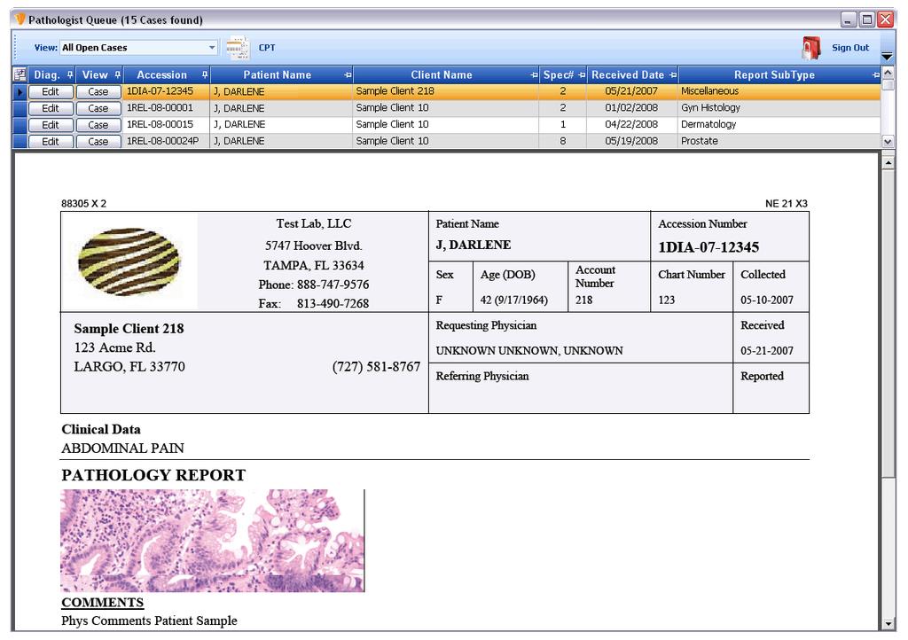 SIGNING OUT CASES 3. By Selecting the Sign Out Cases Button within the Remote Pathologist Module, the Pathologist Queue window, as seen below, will appear.