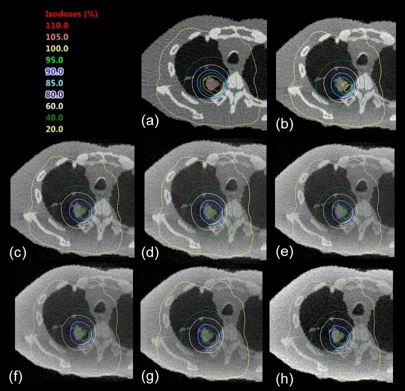 These lung images were reconstructed by using scattered photons at different ratios; (a):
