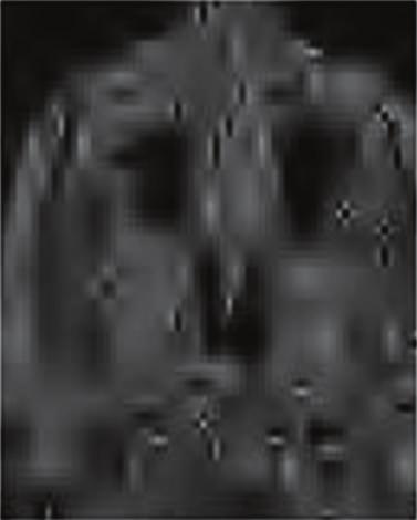 (c) The improved wavelet threshold algorithm. it affects the denoising effect of image directly.