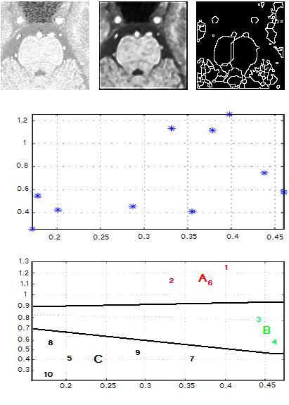 (a) Biomedical image (b) Filtering (c) Segmentation (d) DFT features of image segments (e) Classification of feature vectors by Kohonen s method Figure 4: Processing stages of a selected biomedical