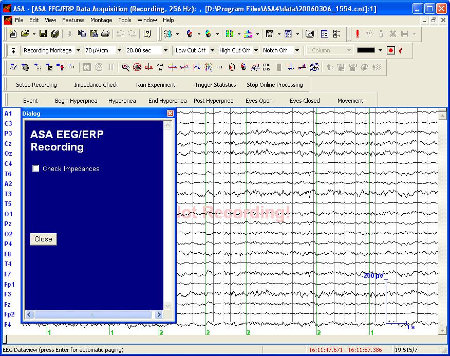 Step 2: Select the Recording Montage EEG and Video Data Acquisition with ASA Figure 4: EEG online preview.