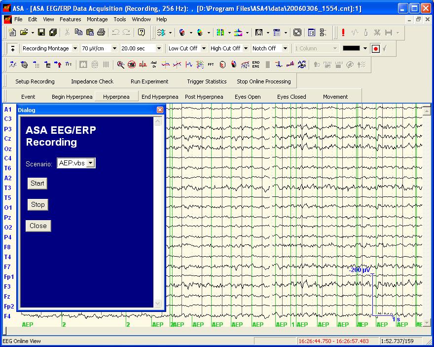 Step 4: ASA EEG/ERP Recording EEG and Video Data Acquisition with ASA After closing the impedance check, the impedance check dialog is replaced by a dialog to start the recording, i.e. saving the incoming data to the EEG data file.