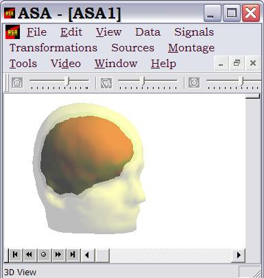 Matching the standard electrodes position to the headmodel In order to perform inverse solution analysis using individual headmodels you should also provide the electrodes 3D position file.