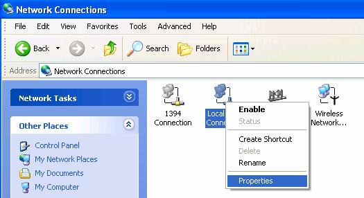 Right Click on the Local Area Connection Icon and select properties.