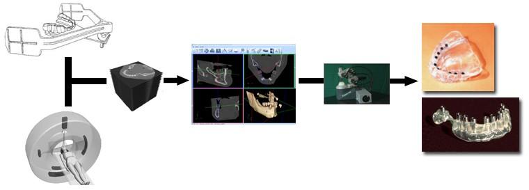 Fully 3D software avoid human mistakes in implants insertion into the bone structure. The overall approach is shown in Fig. 2.