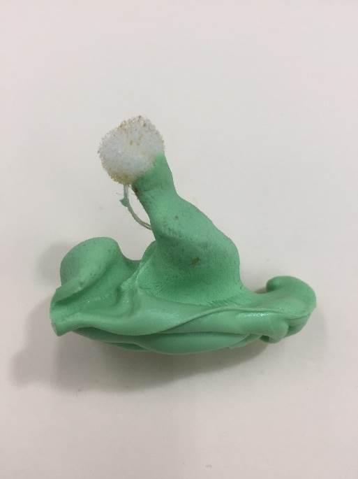 Medical Applications of RP 3D printing applications in medical field can be categorized in the following categories: tissue and organ fabrication, prosthetics, implants,