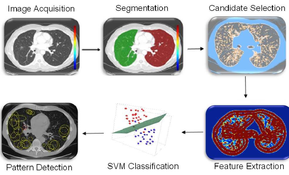III TIB patterns in the patches. The details of the proposed methods are presented below. I. Segmentation: Segmentation is often the first step in CAD systems. There Fig. 2.