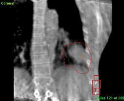 rotations deformations Clinical uses of CBCT