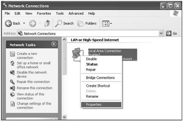 Figure 4-1 2) Select Local Area connection, right click, then choose