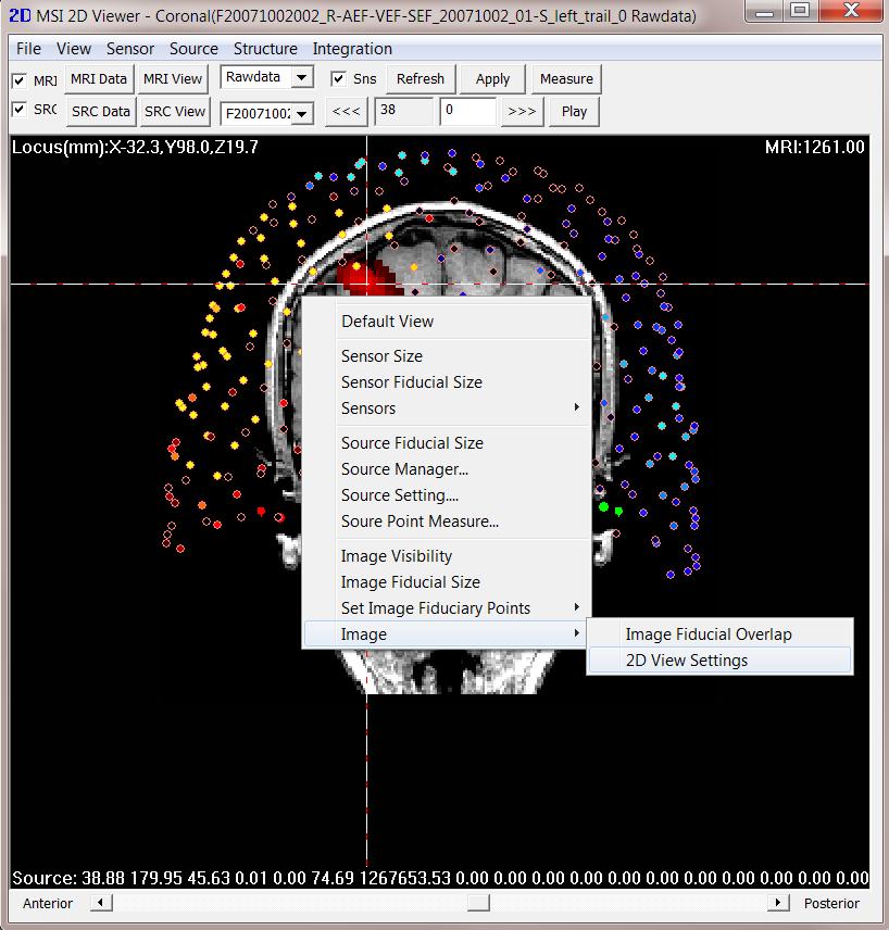Popup Menu in 2D Viewers When an MEG/EEG, Source images and/or MRI/CT data have been loaded into MSI 2D Viewer, you may specific view and set certain image parameters via a Popup menu.