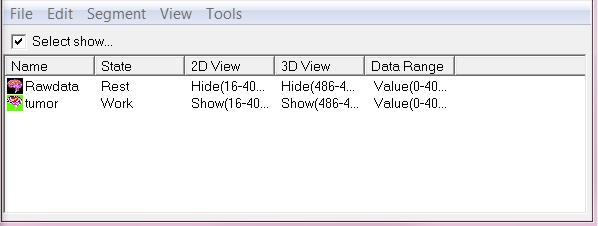 Launch the source analysis window. Of note, click on the 2D viewer will measure the voxel values of the point, which is currently selected with two-select line in the 2D viewers.