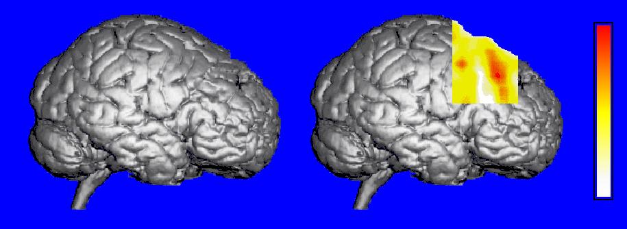 3.3 Integrated image display 35 A B Figure 3.6 Multimodal window display. Frame (A) shows a volumetric rendering of the brain from the MR T1 images (voxel gradient shading).