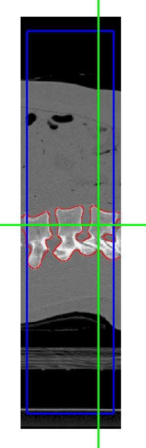 In the next experiment (Figure 4b) we segmented a 3D T1 MRI simulated brain image from the BrainWeb 13 with size of 217 217 181 pixels and default settings (1mm slice