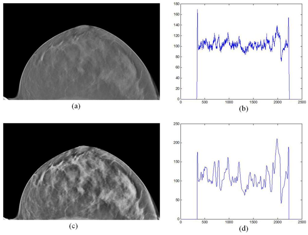 Qin et al. Page 12 Figure 4. The comparison of the image intensities between the original image (a) and the preprocessed image (c).