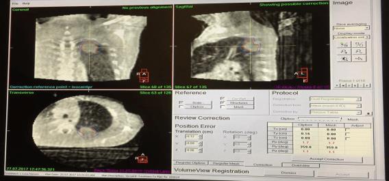 4D-CBCT imaging dose 4D-CBCT protocol: 200º, 4min, 1320 projections, 20mA PMMA phantom with D=32cm, Length=45cm. TLD every 1.