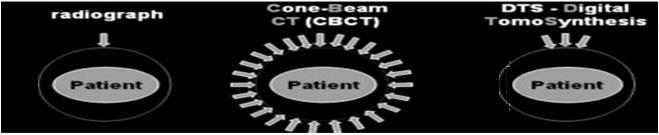 Background: On-board X-ray based Imaging Techniques Radiograph Cone beam CT (CBCT) Digital