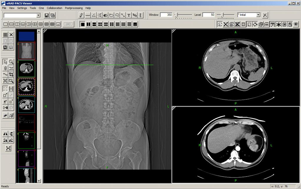 erad Full Viewer The erad Full Viewer is a full-featured application that displays diagnostic quality DICOM images.
