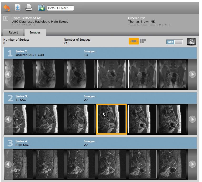 Images Tab The Images Tab shows all images acquired during the patient s exam, organized in series. 3 Image Viewer Options 1.