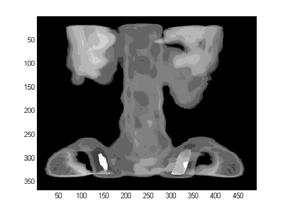 3891.4497.3587 Meshgrid.3866.4215.3349 Figure 15: Meshgrid, a scientific plot. Figure 16: Bone, a medical (x-ray) image. Figure 14: Style, an animation image.