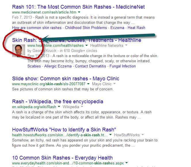 5) Using the Google keyword operator (inanchor) I will open another browser tab and type into Google this: inanchor: "skin rash" 6) The websites that come up above are the sites that actually have a