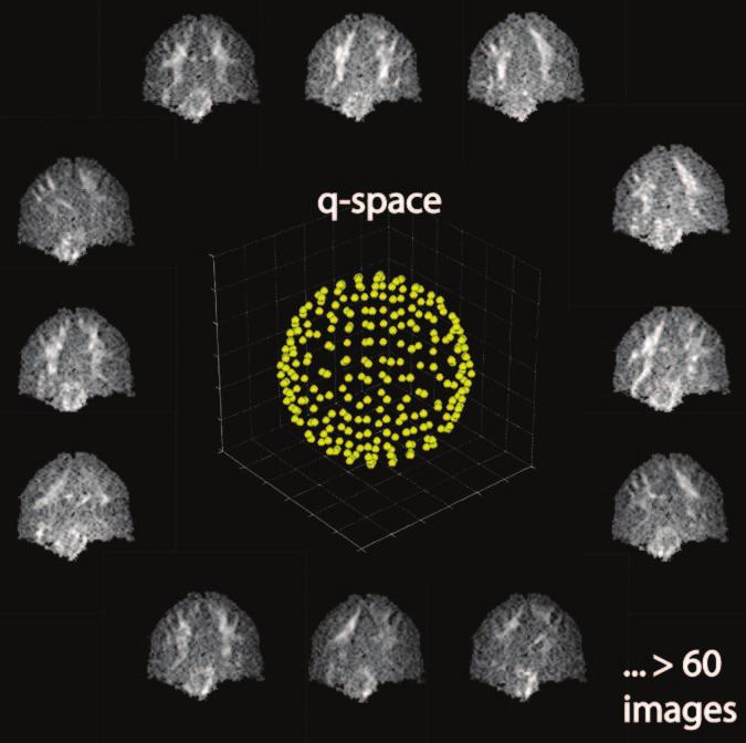 RG f Volume 26 Special Issue Hagmann et al S219 Figure 18. Diagram shows that in q-ball imaging, points on a shell with a constant b value are acquired in q-space.