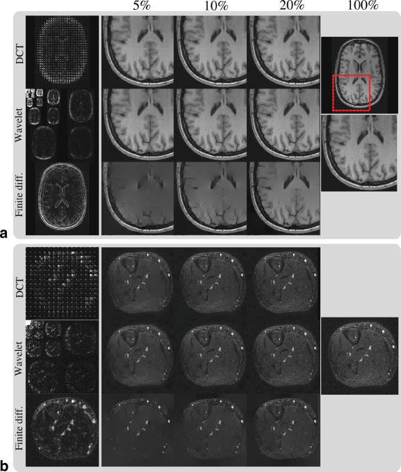 1186 Lustig et al. FIG. 3. Transform-domain sparsity of images. (a) Axial T 1 weighted brain image; (b) axial 3D contrast enhanced angiogram of the peripheral leg.