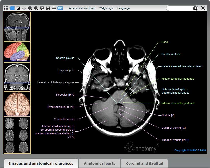 The anatomy atlas tab comprises: A function bar at the top (in red); One or several images on the left, enabling orientation via cross-references (in blue); A series of images that can be scrolled by