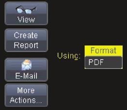 Print Button Can be defined to perform any of the above functions with one button push.