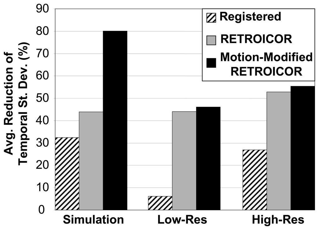 Jones et al. Page 17 Figure 6. Performance of the motion-modified RETROICOR in the simulation and subject data.