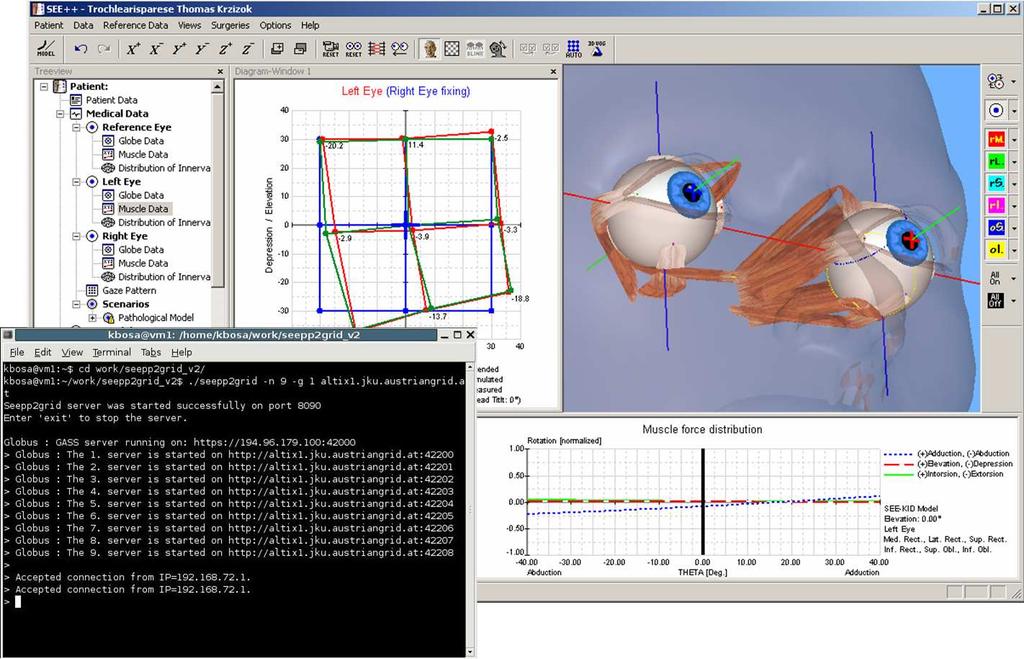 A Grid Software for Virtual Eye Surgery Based on Globus 4 and glite (DRAFT) Károly Bósa, Wolfgang Schreiner, Michael Buchberger and Thomas Kaltofen Research Institute for Symbolic Computation (RISC),