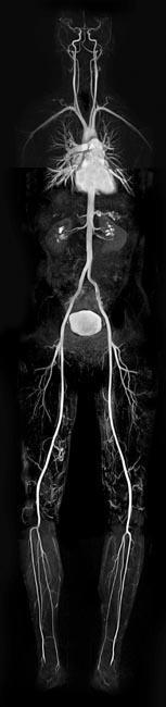 Vascular Imaging There are several methods that can be used to evaluate the cardiovascular systems