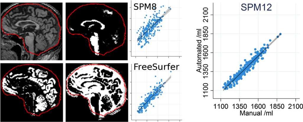 Tissue segmentation in SPM12 vs SPM8 Evaluation of SPM12 versus SPM8