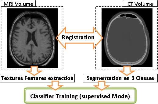 1. The training step : The training dataset comprising an MR image and a corresponding CT image for the same subject is given.