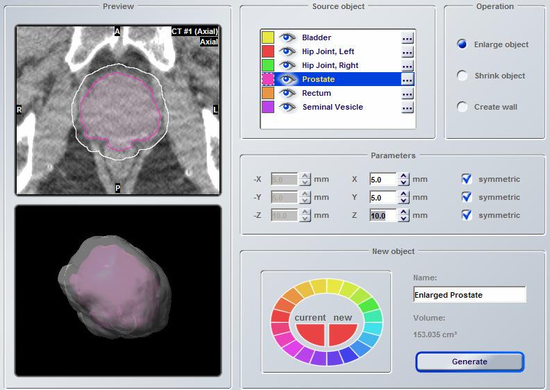 iplan RT Image makes this fast and precise with in-depth 3-D object handling for fast